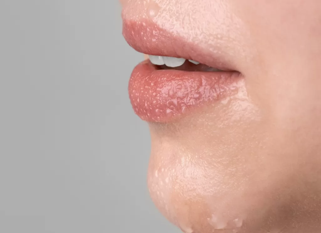 wet lips and sweaty face of woman 